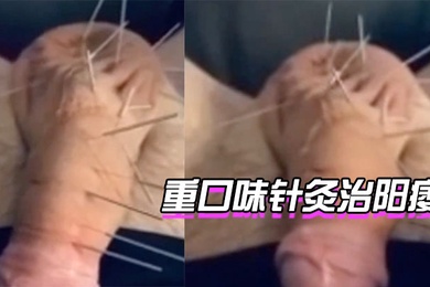 针灸治阳痿你想试下吗